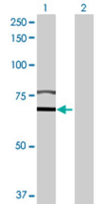 Lane 1: DLAT transfected lysate (71.28 KDa) Lane 2: Non-transfected lysate.