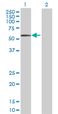 Lane 1: PDHX transfected lysate (55.22 KDa) Lane 2: Non-transfected lysate.