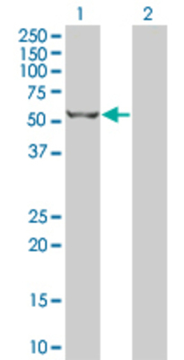 Lane 1: DIAPH1 transfected lysate (44.44 KDa). Lane 2: Non-transfected lysate.