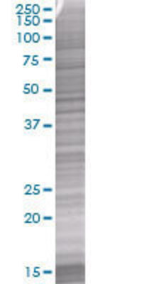 C5R1 transfected lysate