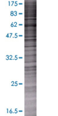 GLB1 transfected lysate.