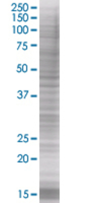 RGS20 transfected lysate.