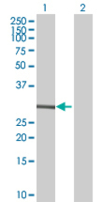 Lane 1: RGS20 transfected lysate (26.62 KDa) Lane 2: Non-transfected lysate.