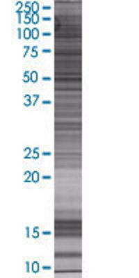 ACAD10 transfected lysate.