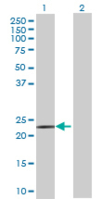 Lane 1: ACAD10 transfected lysate (26.18 KDa) Lane 2: Non-transfected lysate.