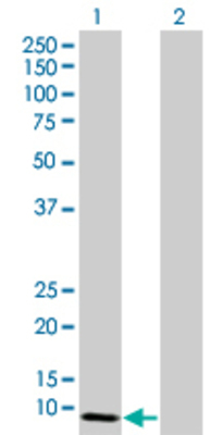 Lane 1: SIVA1 transfected lysate (25.41 KDa) Lane 2: Non-transfected lysate.