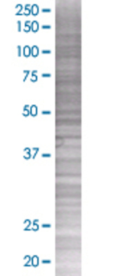 CALCA transfected lysate