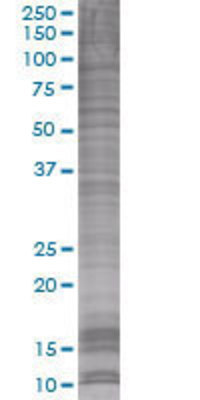 PEMT transfected lysate