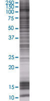 TRIM28 transfected lysate.