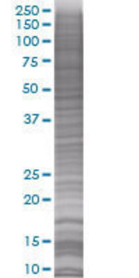 PACAP transfected lysate