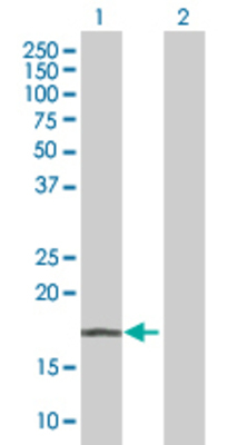 Lane 1: PACAP transfected lysate (20.9 KDa). Lane 2: Non-transfected lysate.