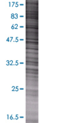 PDXK transfected lysate.