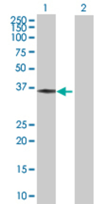 Lane 1: PDXK transfected lysate (34.43 KDa) Lane 2: Non-transfected lysate.