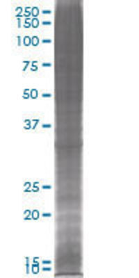 PPP1R3B transfected lysate