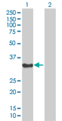 Lane 1: PPP1R3B transfected lysate (31.46 KDa). Lane 2: Non-transfected lysate.