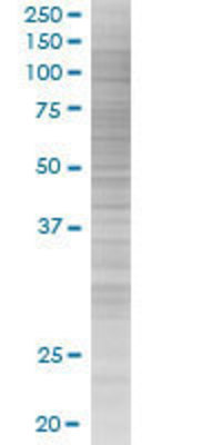 KCNE1 transfected lysate.
