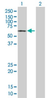 Lane 1: HAPLN1 transfected lysate (39.05 KDa). Lane 2: Non-transfected lysate.