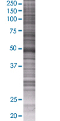PDLIM7 transfected lysate.