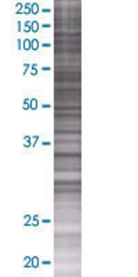 PCBP3 transfected lysate.