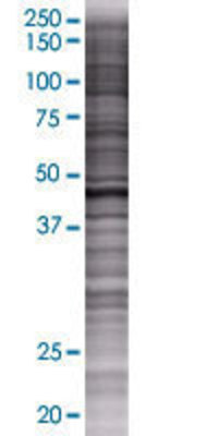 PDIA6 transfected lysate.