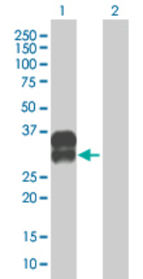 Lane 1: C2orf3 transfected lysate (23.76 KDa). Lane 2: Non-transfected lysate.