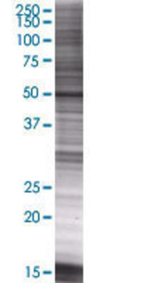 UMPS transfected lysate.