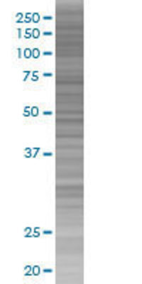 ITGAV transfected lysate.