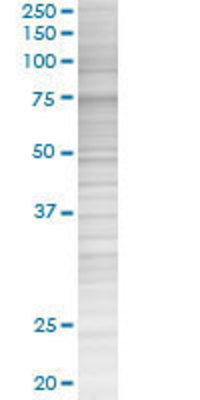 ZYX transfected lysate.