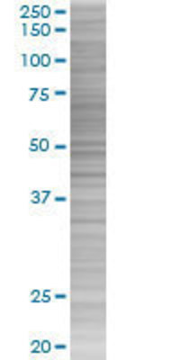 MICA transfected lysate.