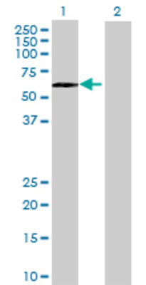 Lane 1: RNF146 transfected lysate (39.49 KDa) Lane 2: Non-transfected lysate.