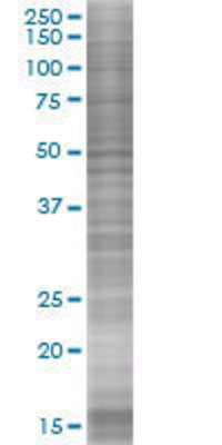 RBMS1 transfected lysate