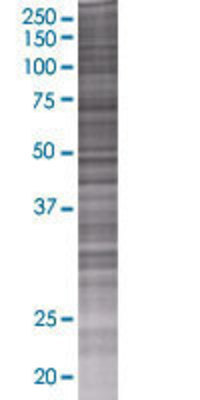 SEC13 transfected lysate.