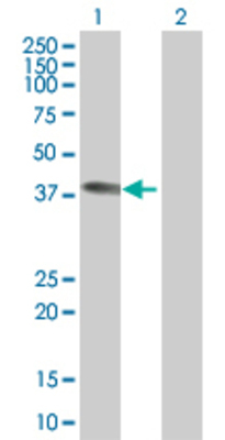 Lane 1: GBL transfected lysate (35.9 KDa). Lane 2: Non-transfected lysate.
