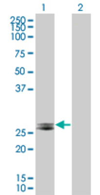Lane 1: FGF23 transfected lysate (28 KDa) Lane 2: Non-transfected lysate.