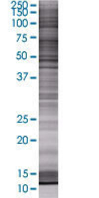 BAALC transfected lysate.