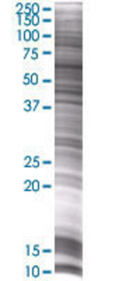 GOLM1 transfected lysate.