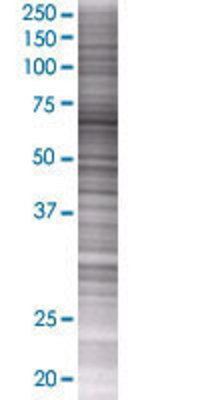 MCTP1 transfected lysate.