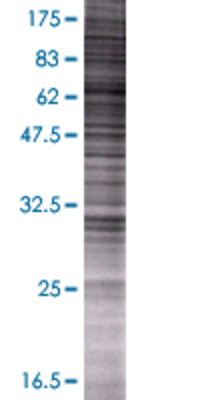 PDE4A transfected lysate.