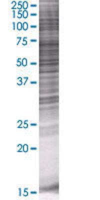 PRMT2 transfected lysate.