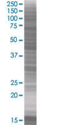 ILKAP transfected lysate.