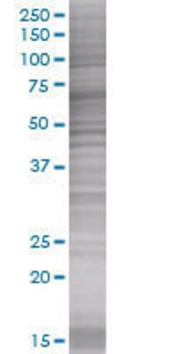 IL8 transfected lysate.