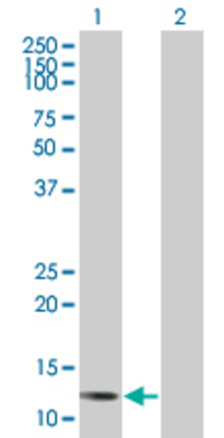 Lane 1: IL8 transfected lysate (10.89 KDa) Lane 2: Non-transfected lysate.