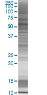 SNTA1 transfected lysate.