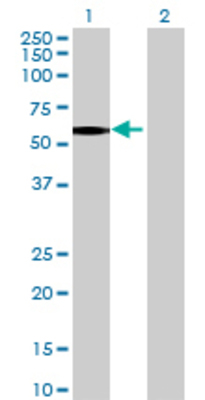 Lane 1: PFKFB2 transfected lysate (55.66 KDa) Lane 2: Non-transfected lysate.