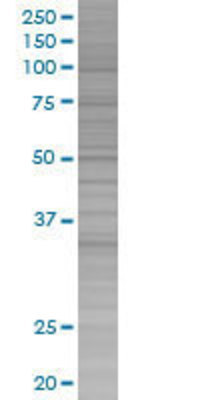 ITPK1 transfected lysate.