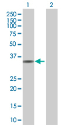 Lane 1: ITPK1 transfected lysate (35.6 KDa) Lane 2: Non-transfected lysate.