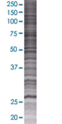 ITGB1BP3 transfected lysate.