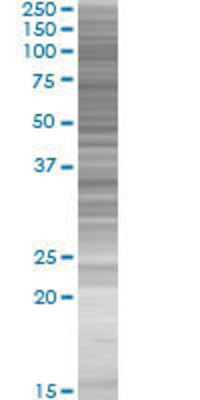 SGCD transfected lysate.