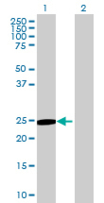 Lane 1: ITGB1BP3 transfected lysate (25.41 KDa) Lane 2: Non-transfected lysate.