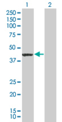 Lane 1: CDK7 transfected lysate (38.17 KDa) Lane 2: Non-transfected lysate.